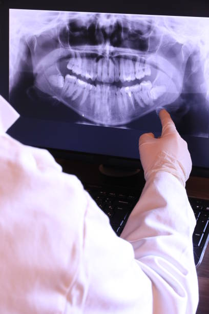 Best Broken or Cracked Tooth Emergency Dentist in Cedar Glen West, NJ