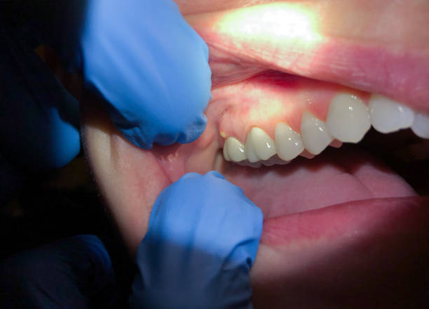 Best Pediatric Emergency Dentist in Cedar Glen West, NJ