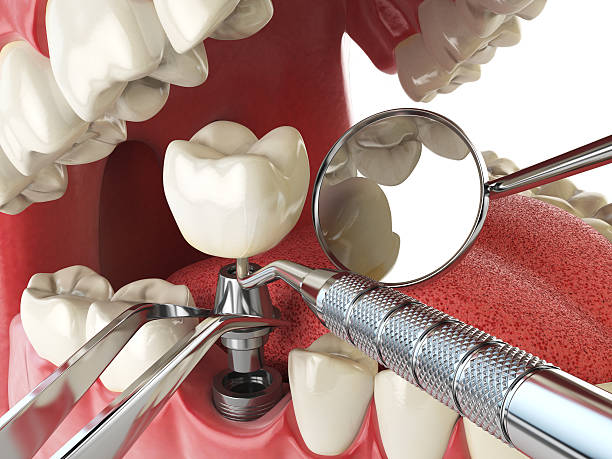 Best Emergency Dental Extractions in Cedar Glen West, NJ
